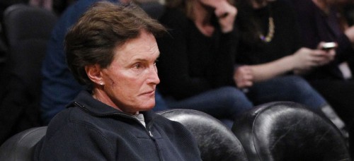 In this Jan. 2012 photo, former Olympic athlete Bruce Jenner, with stitches and a scar on his face, attends an NBA basketball game between the Dallas Mavericks and Los Angeles Lakers in Los Angeles. (AP Photo/Danny Moloshok)