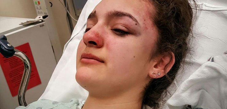 DePaul student attacked on Blue Line returning home from class