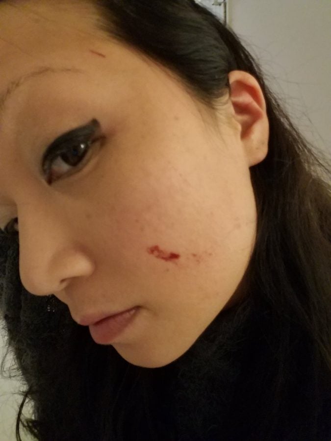 Photos from Kim’s Twitter page show injuries to her face and legs from the incident.